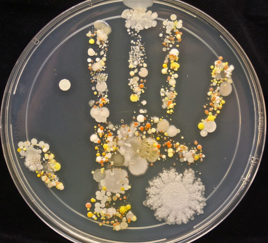 Prerano, previše vakcine: kultura bakterija sa dječijeg dlana