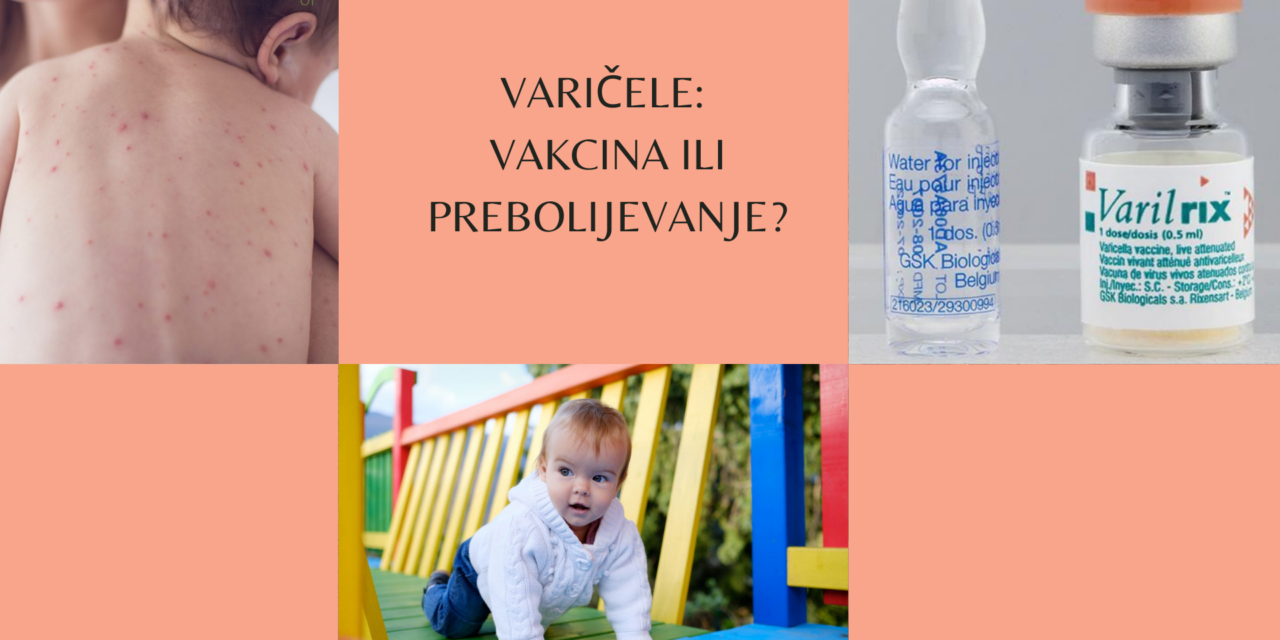 Vodene kozice/ varičele i vakcinacija: bolje bi bilo vakcinisati